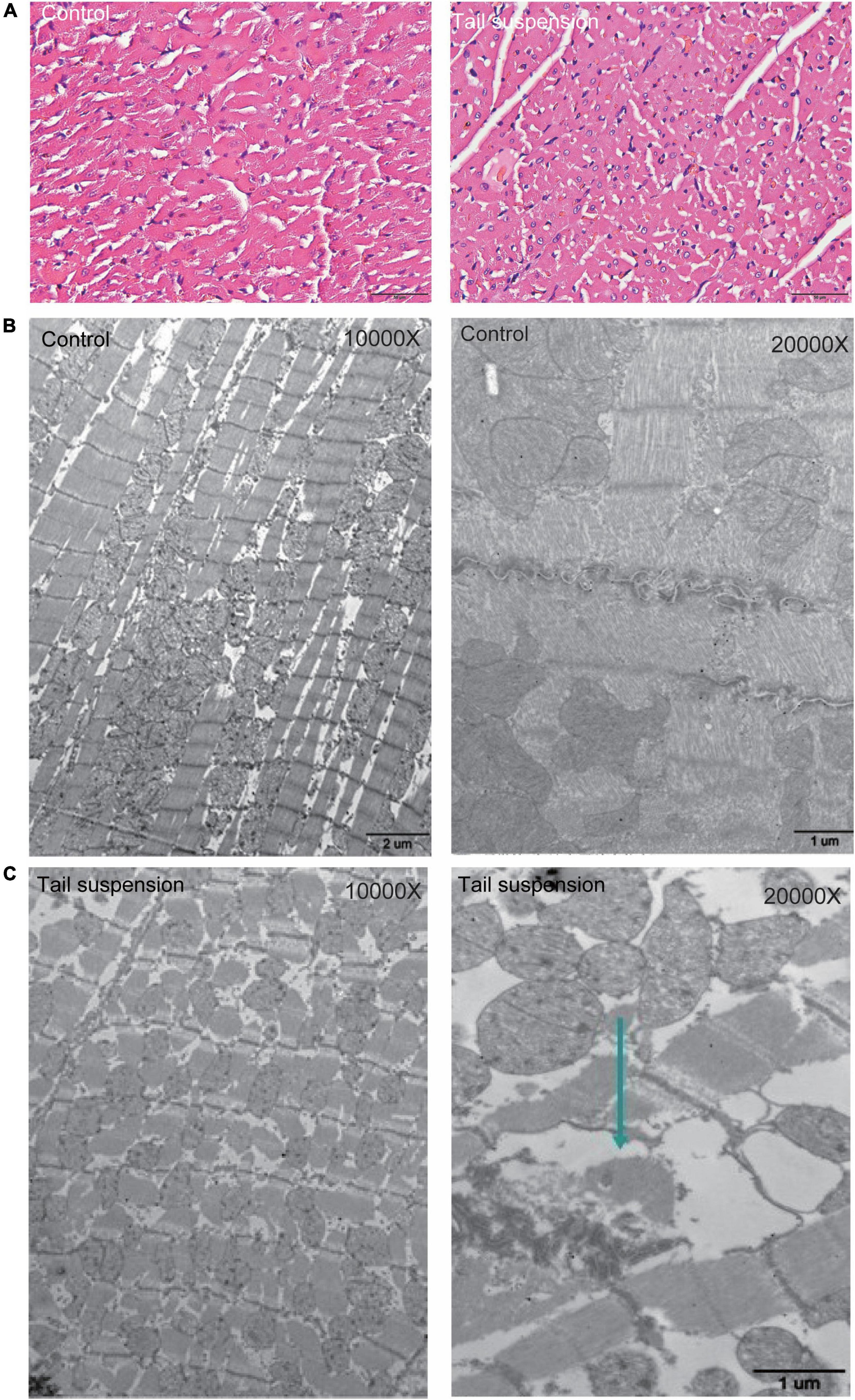 Comprehensive analysis of transcriptomics and metabolomics to understand tail-suspension-induced myocardial injury in rat